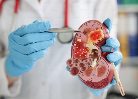 Nephrology